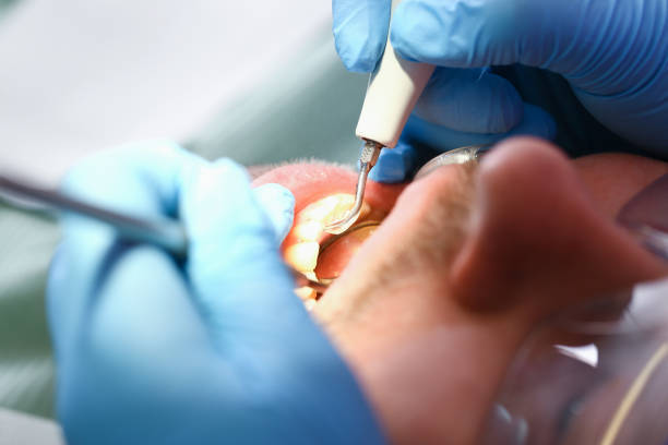 Best Pediatric Emergency Dentist in New London, TX