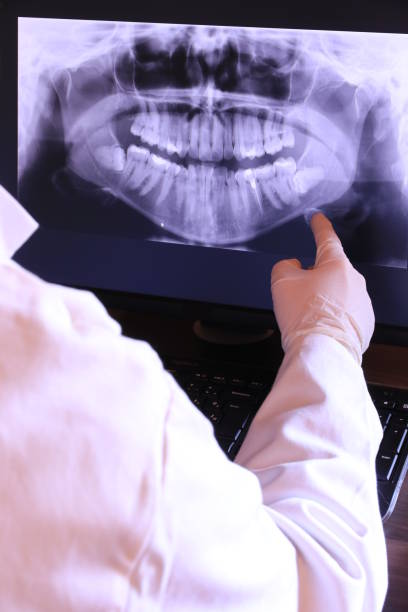 Best Emergency Root Canal Treatment in New London, TX