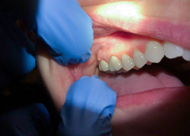 Best Same-Day Emergency Dental Services in New London, TX