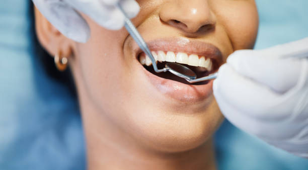 Best Emergency Tooth Extraction in New London, TX