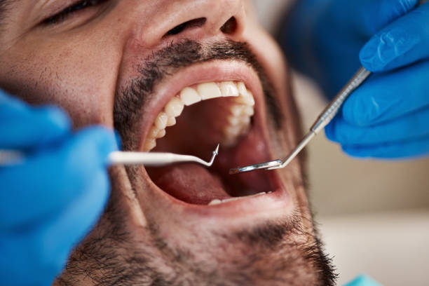 Best Weekend Emergency Dentist in New London, TX