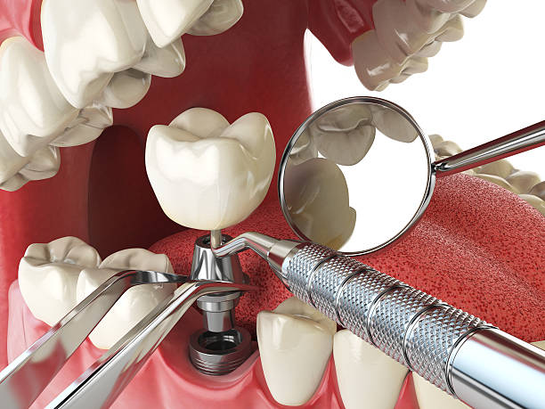 Best Same-Day Emergency Dental Services in New London, TX
